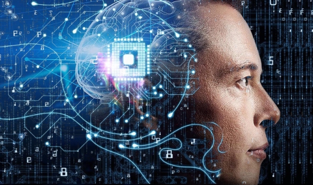 4 soruda Neuralink implantına dair bilinenler