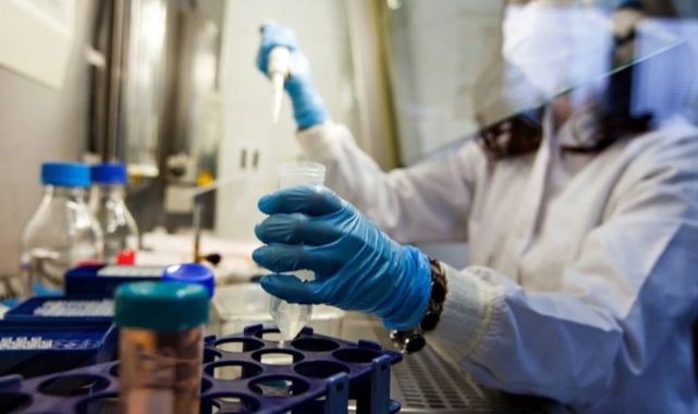 AIDS'te yeni tedavi umudu