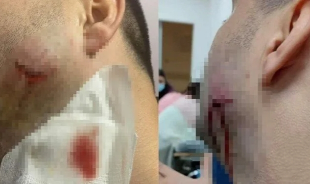 Sağlıkçılara saldırı iddiası: Jandarma personeli açığa alındı