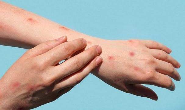 Dünya Sağlık Örgütü küresel acil durum ilan etti