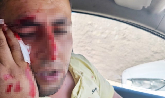 Elektrik dağıtım şirketi personeline saldıran 2 kişi tutuklandı