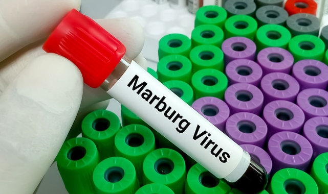Marburg Virüsü Nedir? Tedavi Edilebilir mi?
