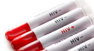 AIDS nedir?