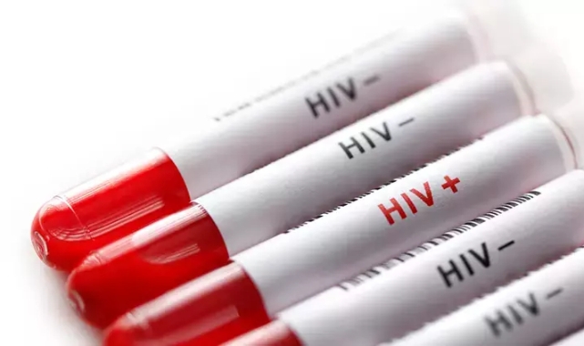 AIDS nedir?