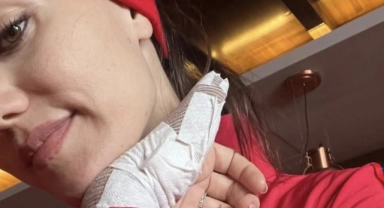 Fahriye Evcen kayak yaparken kaza geçirdi