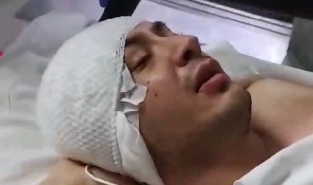 Uzman çavuşun inanılmaz kurtuluşu