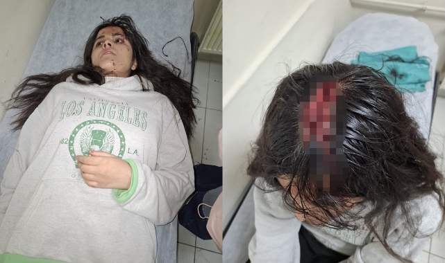 Hakkari'de genç kızın başına buz kütlesi düştü