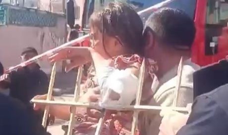 Sivas’ta kolu korkuluğa saplanan 7 yaşındaki çocuk yaralandı