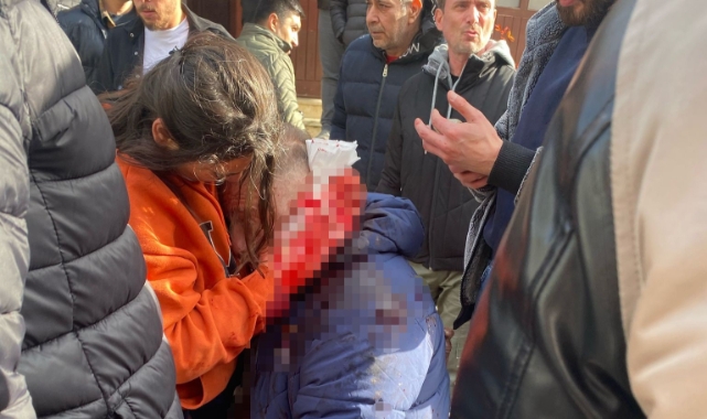 Bartın'da falçatalı kavga!1 yaralı