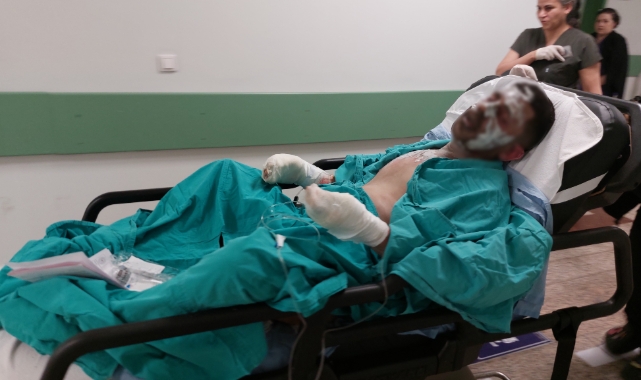 Samsun'da ateşe tiner döken genç ağır yaralandı