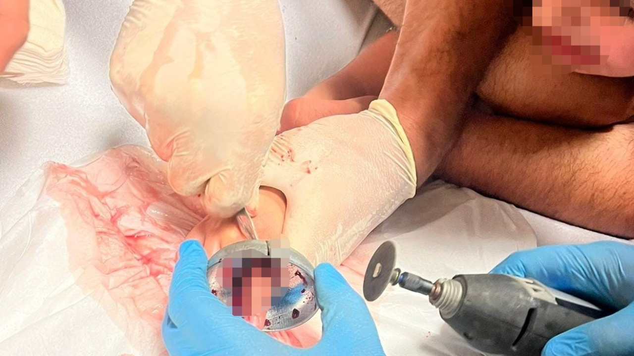 Bursa’da çocuğun parmağı çeşme aynasına sıkıştı