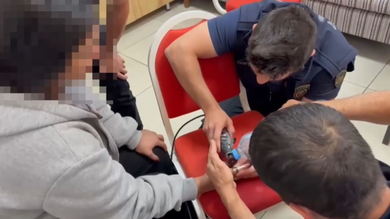Yüzük kadının parmağına sıkıştı!