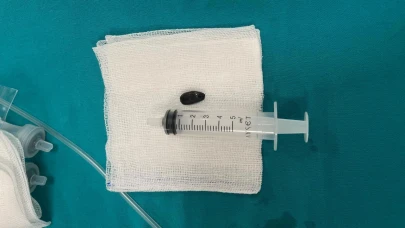 Çekirdek kabuğu yutan bebek neredeyse ölüyordu