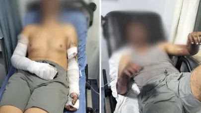 Manisa sanayi sitesinde patlama faciası